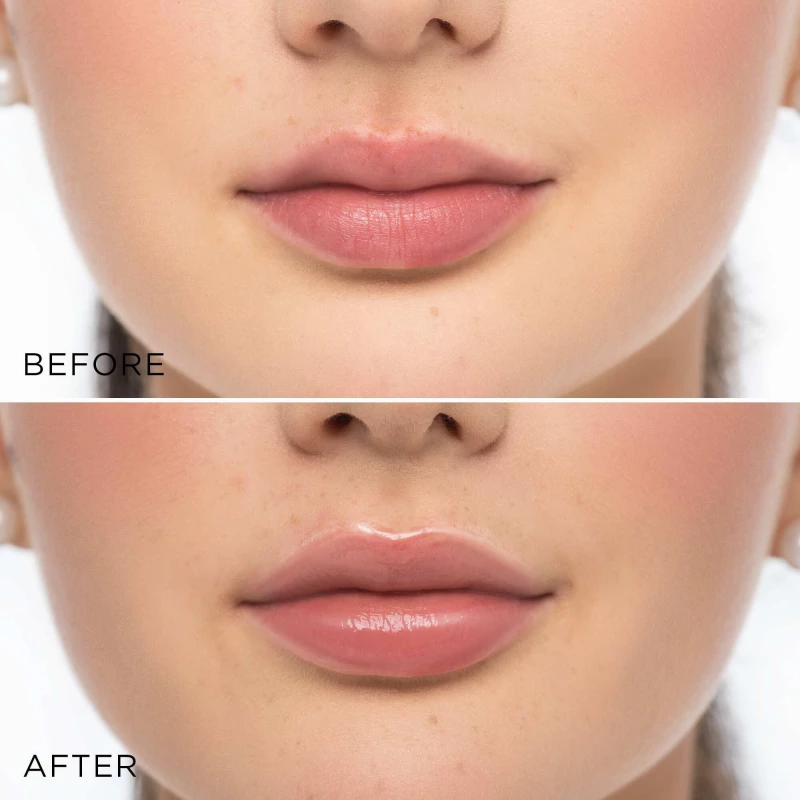 Glossy Lip Volumizer | GLOSSY LIP VOLUMIZER