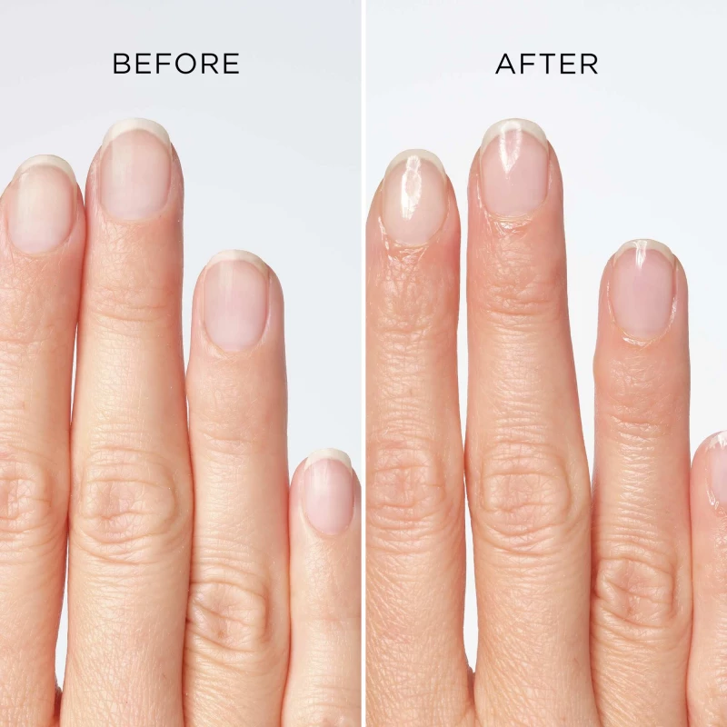 Nail Repair Serum | NAIL REPAIR SERUM