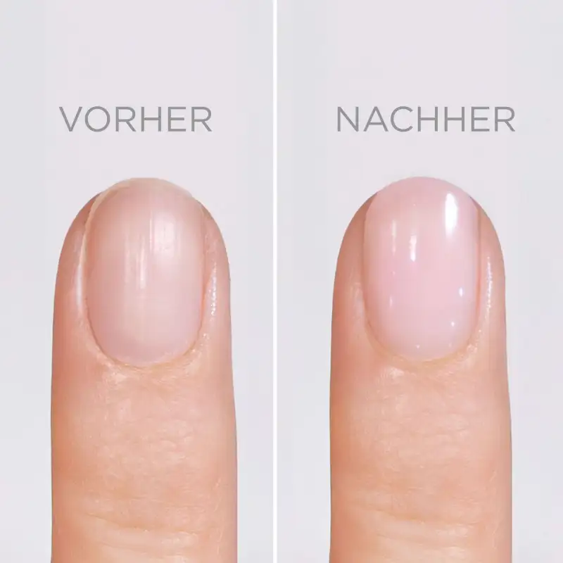 SOS Nail Repair | SOS NAIL REPAIR